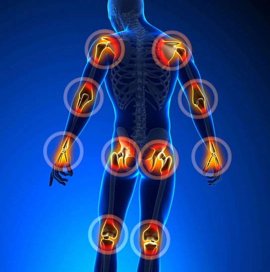 joint-pain-areas-ouch